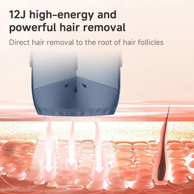 Mlay T18 IPL Hair Removal Device with ICE Cooling