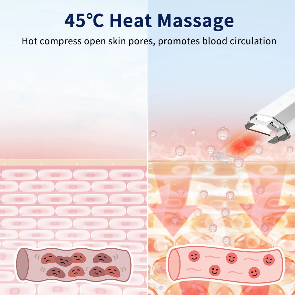 ANLAN Ultrasonic Skin Scrubber & EMS Face Lifter