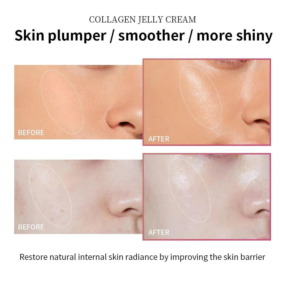 Collagen Jelly Cream – Firming & Hydrating Skincare