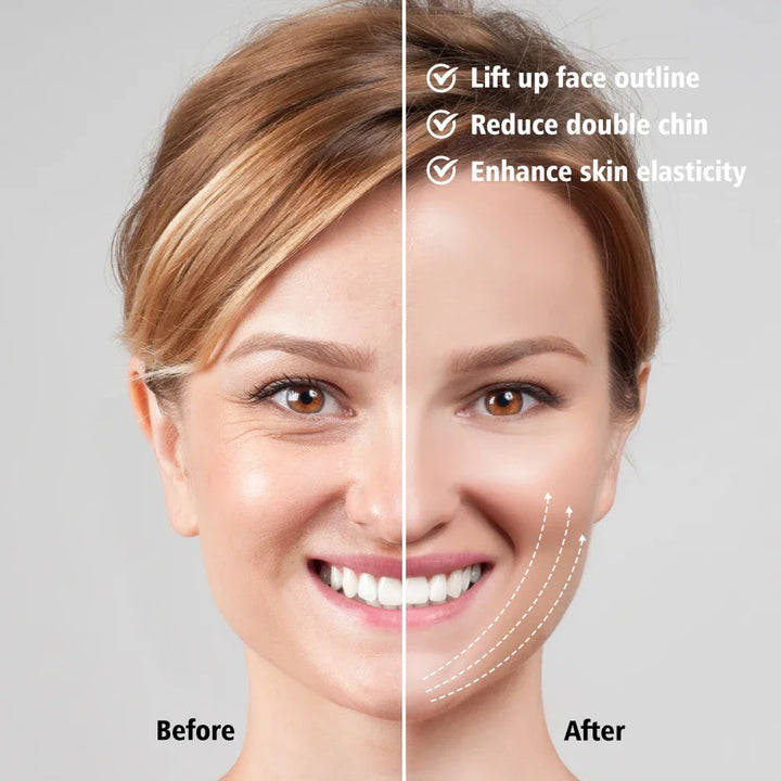 EMS V-Face Lifting Massager – Microcurrent Facial Toning Device