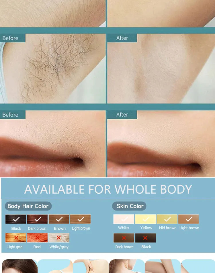 IPL Hair Removal Device – 500,000 Flashes