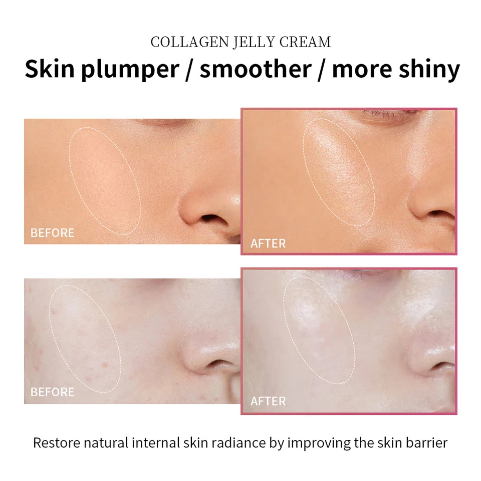 Collagen Jelly Cream – Firming & Hydrating Skincare