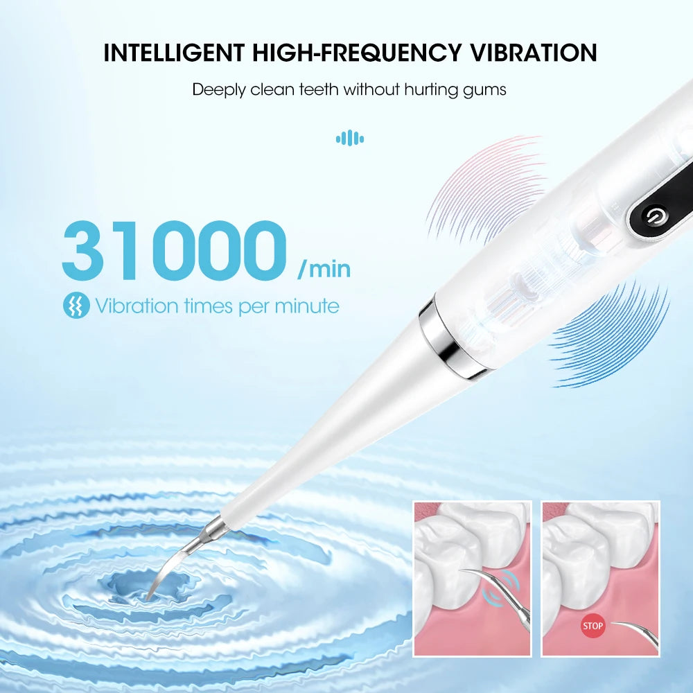 Electric Dental Scaler – Tartar & Plaque Remover