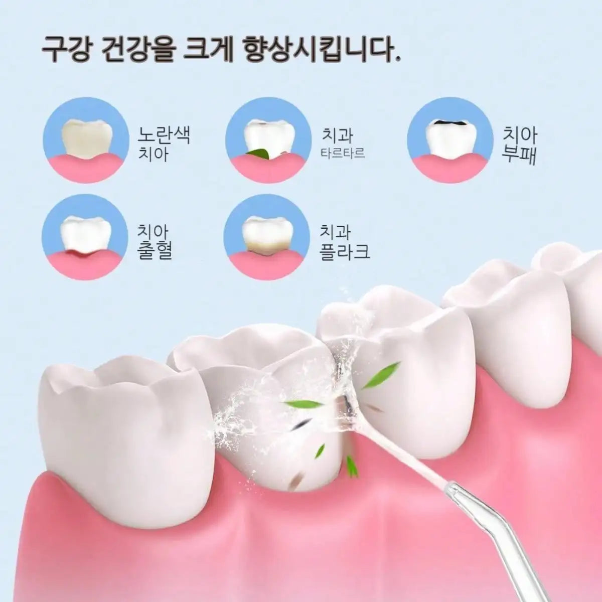 Electric Water Flosser with Smart Pressure Control