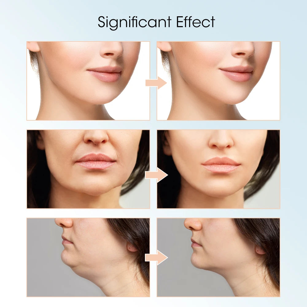 Red Light V-Face Lifting Massager with Remote